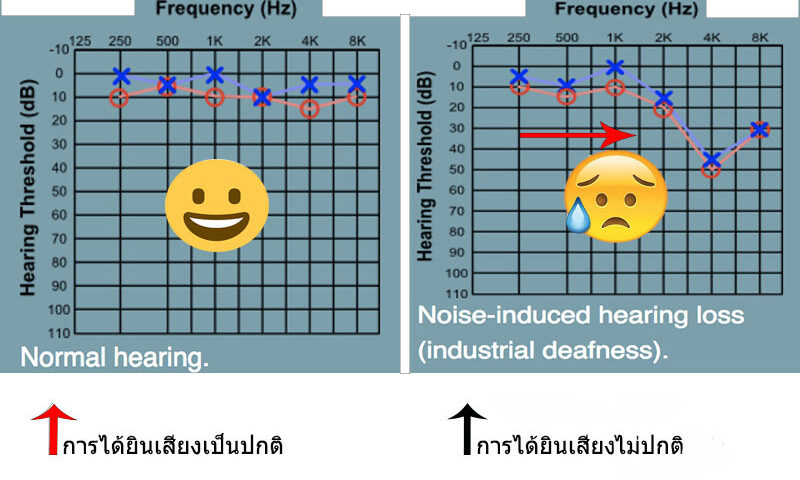 คลินิครับรักษาประสาทหูเสื่อม-ได้ยินเสียงวี๊ดในหูตลอดเวลา คลินิครับรักษาการได้ยินผิดปกติ-สูญเสียการได้ยิน